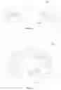 Fig. 02 - Photochemically induced engagement of intraocular implants
