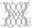 Fig. 01 - DEVICES AND SYSTEMS FOR DOCKING A HEART VALVE