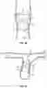 Fig. 08 - DEVICES AND SYSTEMS FOR DOCKING A HEART VALVE