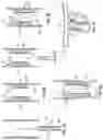Fig. 09 - DEVICES AND SYSTEMS FOR DOCKING A HEART VALVE