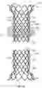 Fig. 32 - DEVICES AND SYSTEMS FOR DOCKING A HEART VALVE