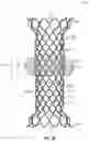 Fig. 33 - DEVICES AND SYSTEMS FOR DOCKING A HEART VALVE
