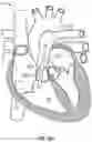 Fig. 40 - DEVICES AND SYSTEMS FOR DOCKING A HEART VALVE