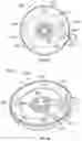 Fig. 74 - DEVICES AND SYSTEMS FOR DOCKING A HEART VALVE
