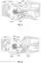Fig. 76 - DEVICES AND SYSTEMS FOR DOCKING A HEART VALVE