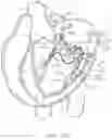 Fig. 28 - Methods and apparatus for engaging a valve prosthesis with tissue