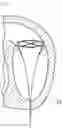 Fig. 01 - ARTIFICIAL HEART VALVE