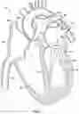Fig. 02 - Percutaneous papillary muscle relocation
