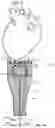 Fig. 02 - Cardiac treatment system and method