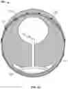 Fig. 06 - Cardiac treatment system and method