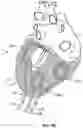 Fig. 09 - Cardiac treatment system and method
