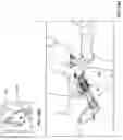 Fig. 35 - Cardiac treatment system and method