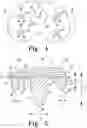 Fig. 04 - Prosthesis with surfaces having different textures and method of making the prosthesis