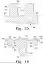 Fig. 09 - Prosthesis with surfaces having different textures and method of making the prosthesis