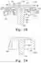 Fig. 16 - Prosthesis with surfaces having different textures and method of making the prosthesis