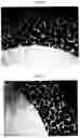 Fig. 30 - Prosthesis with surfaces having different textures and method of making the prosthesis