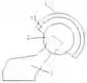 Fig. 01 - Artificial hip joint comprising composite ball