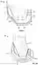 Fig. 05 - Variable thickness femoral augments