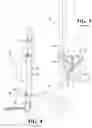 Fig. 03 - Ankle fusion system with expandable spacer