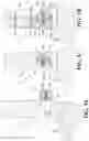 Fig. 09 - Ankle fusion system with expandable spacer