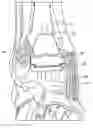 Fig. 01 - Stabilized total ankle prosthesis