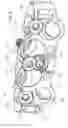 Fig. 06 - Variable lordotic interbody spacer