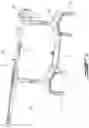 Fig. 03 - Leg length calculation in computer-assisted surgery