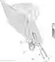 Fig. 04 - Leg length calculation in computer-assisted surgery