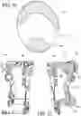 Fig. 06 - Liner for orthopedic or prosthetic device