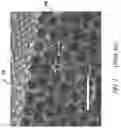 Fig. 02 - Corrugated microporous tissue interface for improved performance and infection resistance of vascular grafts and other implantable devices