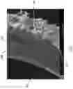 Fig. 04 - Corrugated microporous tissue interface for improved performance and infection resistance of vascular grafts and other implantable devices
