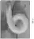 Fig. 07 - Corrugated microporous tissue interface for improved performance and infection resistance of vascular grafts and other implantable devices
