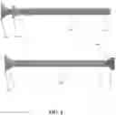 Fig. 04 - DEVICES, SYSTEMS, AND METHODS FOR TREATMENT OF SLEEP APNEA