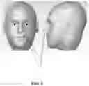 Fig. 07 - DEVICES, SYSTEMS, AND METHODS FOR TREATMENT OF SLEEP APNEA