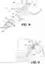Fig. 06 - Device and method for reducing intraocular pressure