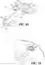 Fig. 09 - Device and method for reducing intraocular pressure