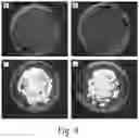 Fig. 09 - METHOD OF INHIBITING HARMFUL MICROORGANISMS AND BARRIER-FORMING COMPOSITION THEREFOR