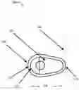 Fig. 01 - Vaginal inserted estradiol pharmaceutical compositions and methods