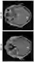 Fig. 06 - METHODS FOR MODULATION OF CAR-T CELLS