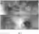 Fig. 02 - Self Assembling Peptide Matrix for the Prevention of Esophageal Stricture After Endoscopic Dissection