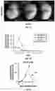 Fig. 02 - Compositions and methods relating to myomaker-induced muscle cell fusion