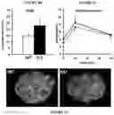 Fig. 06 - METHODS FOR TREATING METABOLIC DISORDERS USING FGF
