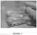Fig. 07 - Hydrogel medium for the storage and preservation of tissue