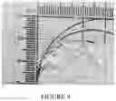 Fig. 09 - Hydrogel medium for the storage and preservation of tissue