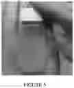 Fig. 10 - Hydrogel medium for the storage and preservation of tissue
