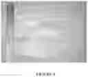 Fig. 11 - Hydrogel medium for the storage and preservation of tissue