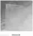 Fig. 14 - Hydrogel medium for the storage and preservation of tissue
