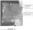Fig. 18 - Hydrogel medium for the storage and preservation of tissue