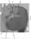 Fig. 09 - Negative pressure wound therapy apparatuses and methods for using the same