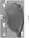 Fig. 33 - Negative pressure wound therapy apparatuses and methods for using the same